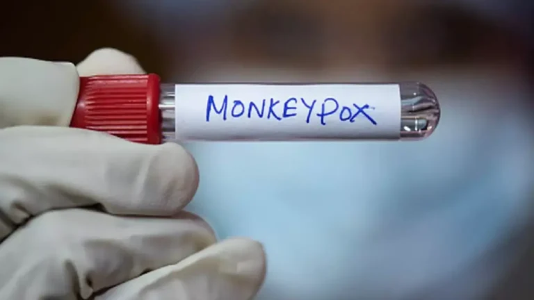monkeybox
